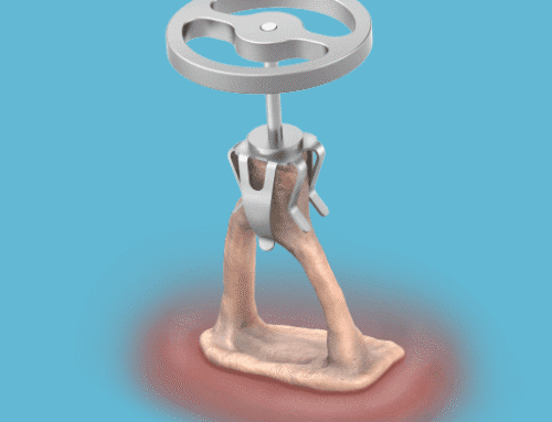 Grace Medical NyteByte Partial