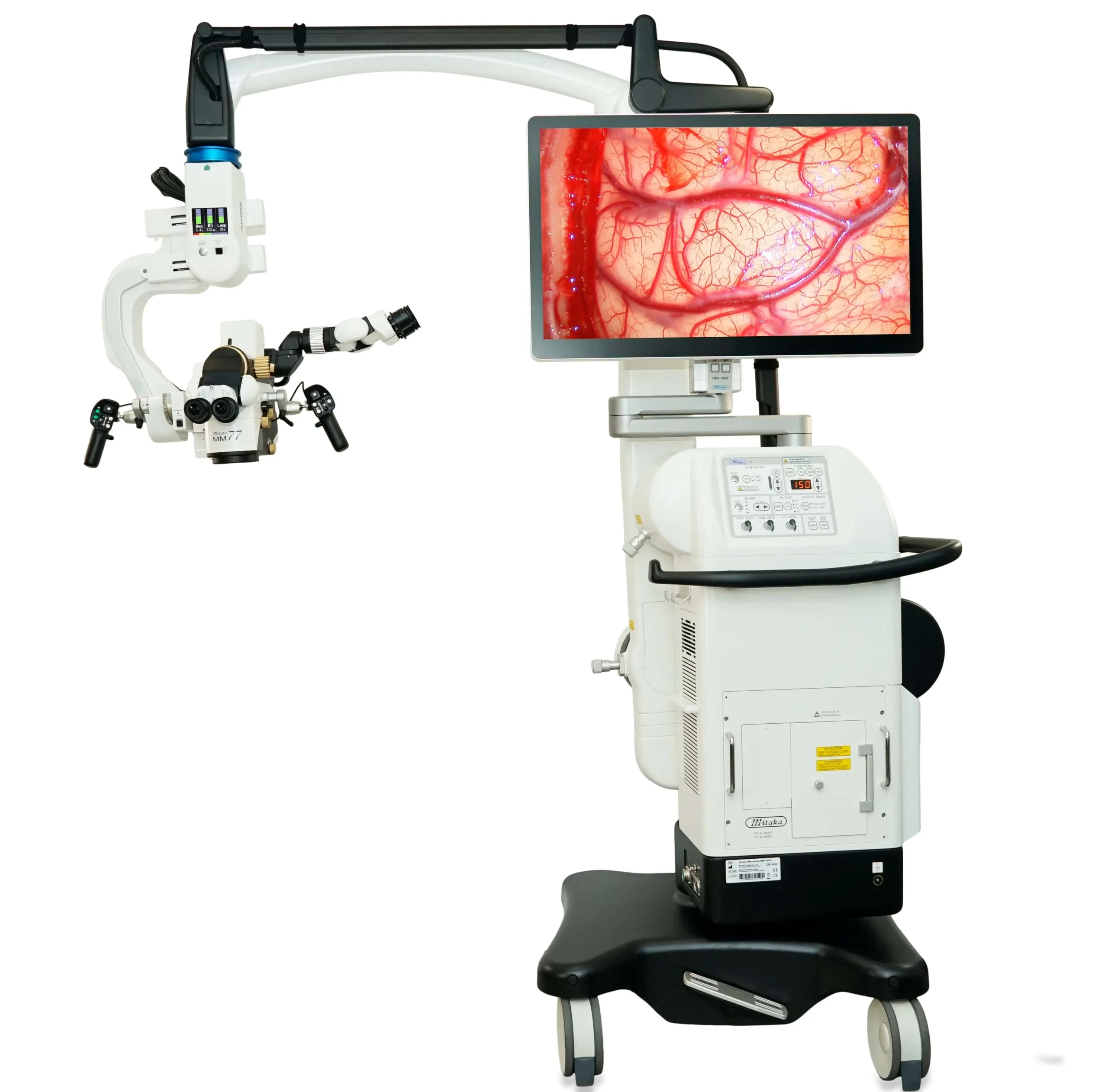 Mitaka’s MM77 Surgical Microscope